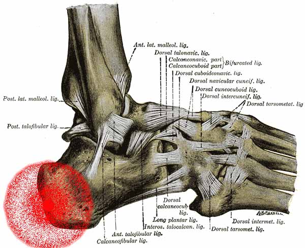 Behandlung von Fersensporn in Braunschweig mit spezialisierten Chiropraktik- und Osteopathie-Methoden, dargestellt durch ein informatives Bild der Fußsohle mit markierten Schmerzpunkten.