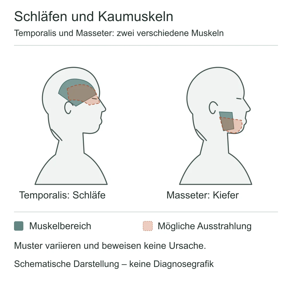 Zwei seitliche Kopfschemata mit Schläfenmuskel und Kaumuskel sowie möglichen Schmerzbereichen an Schläfe, Augenregion und Kiefer.