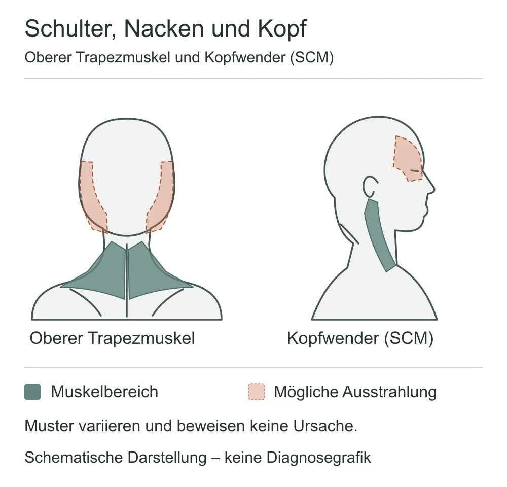 Schematische Darstellung von oberem Trapezmuskel und Kopfwender mit möglichen Ausstrahlungsbereichen an seitlichem Kopf, Stirn und Augenregion.